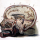 Illustration for article titled Left in the Brain: The Potentially Toxic Residue from MRI Drugs